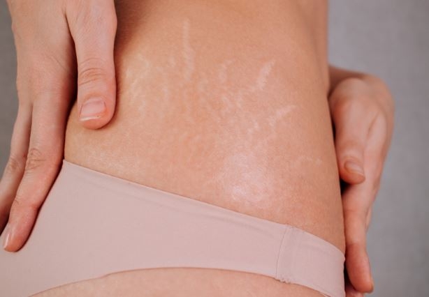 Bonito Beauty Bar: Toronto's Premier Destination for Camouflage Tattoo and Stretch Mark Removal Bonito Beauty Bar: Toronto's Premier Destination for Camouflage Tattoo and Stretch Mark Removal