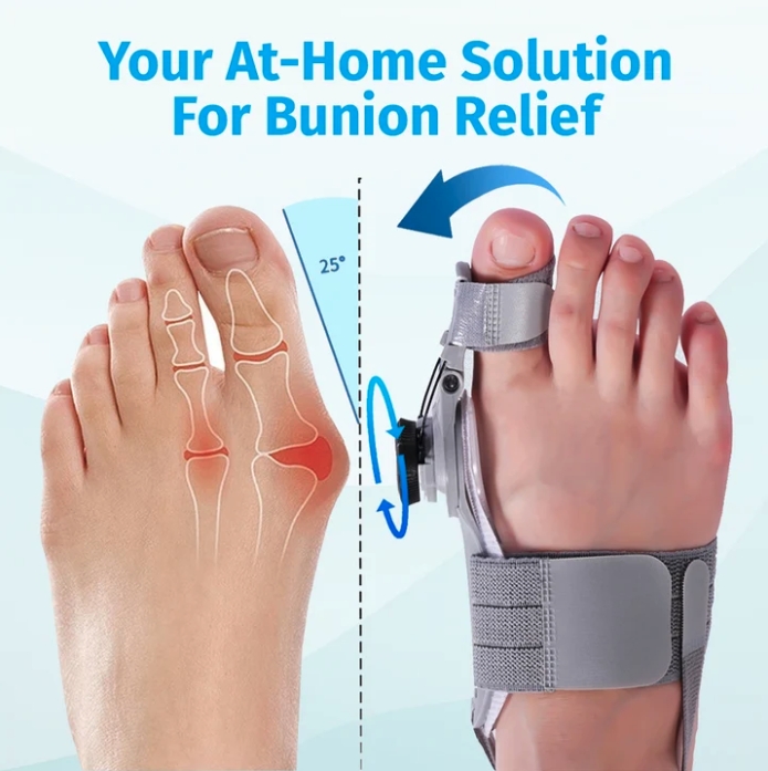 Treatmedy Introduces At-Home Bunion Device Designed to Support Toe Realignment